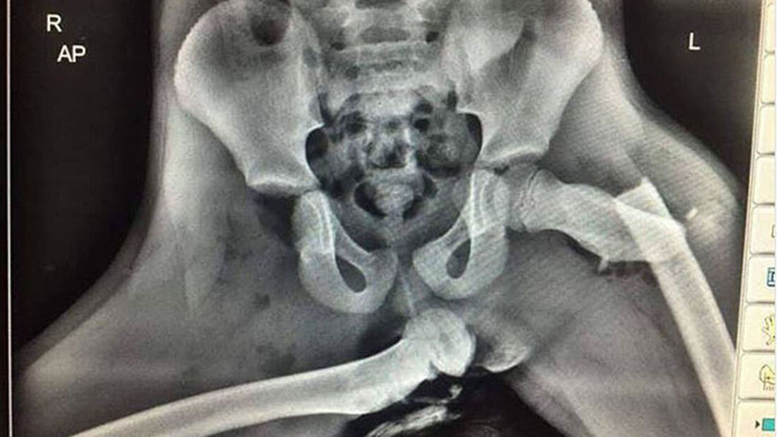 Füße auf dem Armaturenbrett Röntgenbild